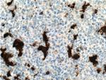 IL18 Antibody in Immunohistochemistry (Paraffin) (IHC (P))