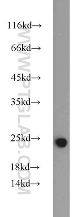 IL18 Antibody in Western Blot (WB)