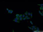 IL18 Antibody in Immunocytochemistry (ICC/IF)