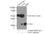 ING5 Antibody in Immunoprecipitation (IP)