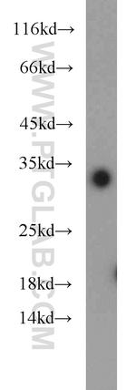 ING5 Antibody in Western Blot (WB)