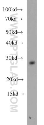 ING5 Antibody in Western Blot (WB)