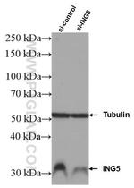 ING5 Antibody in Western Blot (WB)