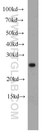 ING5 Antibody in Western Blot (WB)