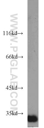 ING5 Antibody in Western Blot (WB)