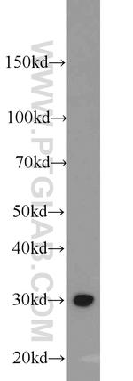 ING5 Antibody in Western Blot (WB)