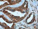 PMM2 Antibody in Immunohistochemistry (Paraffin) (IHC (P))