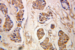 PMM2 Antibody in Immunohistochemistry (Paraffin) (IHC (P))