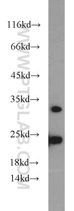 PMM2 Antibody in Western Blot (WB)