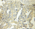 LAMR1/RPSA Antibody in Immunohistochemistry (Paraffin) (IHC (P))