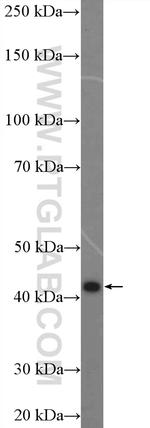 SPHK1 Antibody in Western Blot (WB)