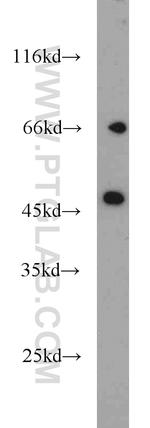 Protein C inhibitor Antibody in Western Blot (WB)