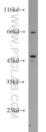 Protein C inhibitor Antibody in Western Blot (WB)