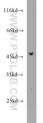 Protein C inhibitor Antibody in Western Blot (WB)