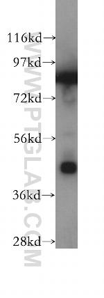 Protein C inhibitor Antibody in Western Blot (WB)