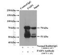 PAIP1 Antibody in Immunoprecipitation (IP)