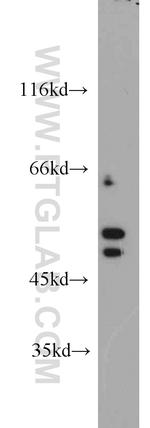 PAIP1 Antibody in Western Blot (WB)