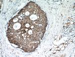 FABP3 Antibody in Immunohistochemistry (Paraffin) (IHC (P))