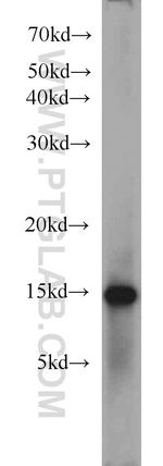 FABP3 Antibody in Western Blot (WB)