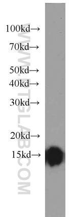 FABP3 Antibody in Western Blot (WB)