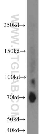 Lumican Antibody in Western Blot (WB)