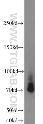 Lumican Antibody in Western Blot (WB)