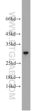 RGS2 Antibody in Western Blot (WB)