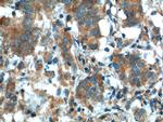 KLK3/PSA Antibody in Immunohistochemistry (Paraffin) (IHC (P))