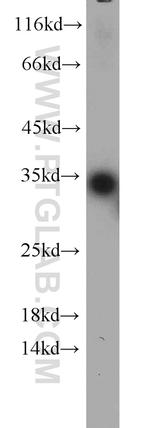 TPMT Antibody in Western Blot (WB)