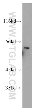 ETV4 Antibody in Western Blot (WB)