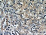 RERG Antibody in Immunohistochemistry (Paraffin) (IHC (P))