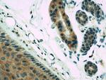 RERG Antibody in Immunohistochemistry (Paraffin) (IHC (P))