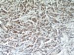 RERG Antibody in Immunohistochemistry (Paraffin) (IHC (P))