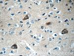 RERG Antibody in Immunohistochemistry (Paraffin) (IHC (P))