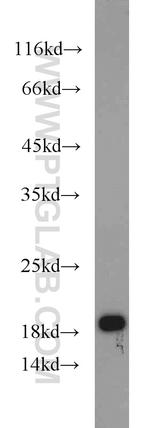 MMS2 Antibody in Western Blot (WB)