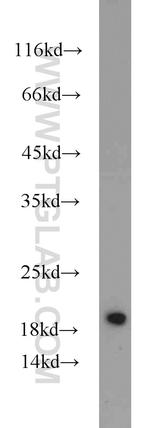 MMS2 Antibody in Western Blot (WB)