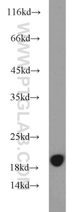 MMS2 Antibody in Western Blot (WB)