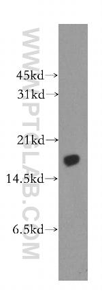 MMS2 Antibody in Western Blot (WB)