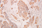 MMS2 Antibody in Immunohistochemistry (Paraffin) (IHC (P))