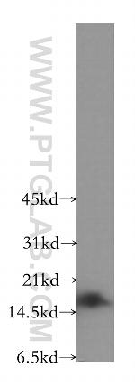 GMF-beta Antibody in Western Blot (WB)