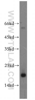 GMF-beta Antibody in Western Blot (WB)