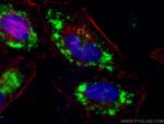 TIP47 Antibody in Immunocytochemistry (ICC/IF)