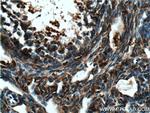 TIP47 Antibody in Immunohistochemistry (Paraffin) (IHC (P))