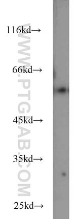 FBXO7 Antibody in Western Blot (WB)