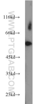 FBXO7 Antibody in Western Blot (WB)