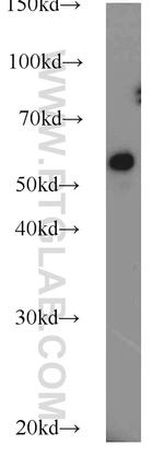 FBXO7 Antibody in Western Blot (WB)