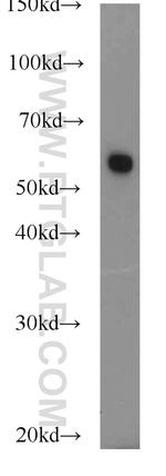 FBXO7 Antibody in Western Blot (WB)