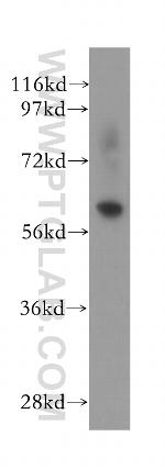 FBXO7 Antibody in Western Blot (WB)