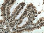 RCC1 Antibody in Immunohistochemistry (Paraffin) (IHC (P))