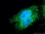 KMO Antibody in Immunocytochemistry (ICC/IF)